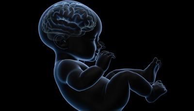 Síndrome de Ohtahara (early infantile epleptic encephalopathy)